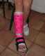 Carlies Gips